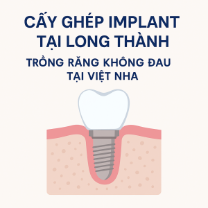 trong-rang-implant-uy-tin-tai-long-thanh-nha-khoa-viet-nha-dong-nai